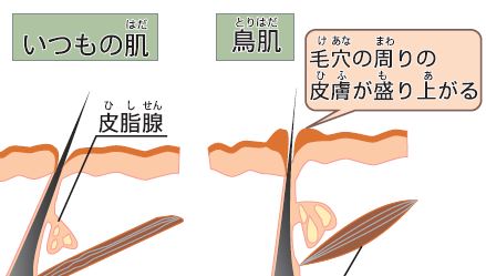 鳥肌はどうしてたつの？【疑問氷解】